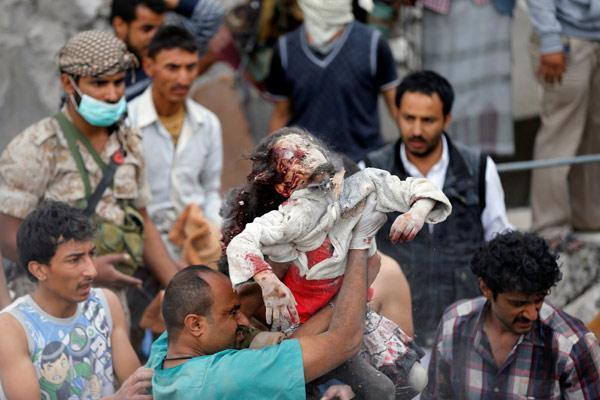 Suudi Arabistan bir katliam daha yaptı: Dünya bu görüntülere suskun - Resim : 1