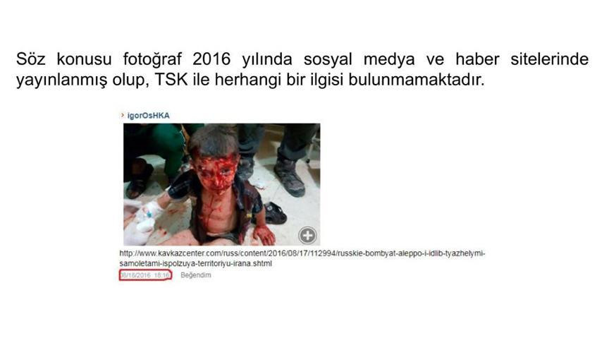 Yaralı çocuk fotoğrafı üzerinden kara propaganda başlatıldı - Resim : 1