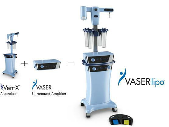 Flora Klinik Vaser Liposuction 4A Tekniği ile İzsiz Yağ Yakımı - Resim : 2