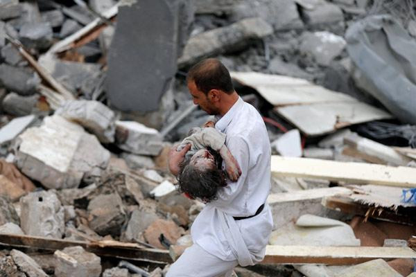 Suudi Arabistan bir katliam daha yaptı: Dünya bu görüntülere suskun - Resim : 12