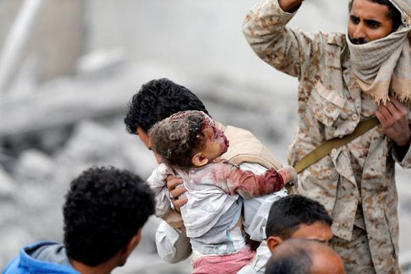Suudi Arabistan bir katliam daha yaptı: Dünya bu görüntülere suskun - Resim : 6