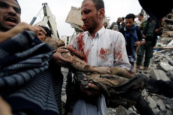 Suudi Arabistan bir katliam daha yaptı: Dünya bu görüntülere suskun - Resim : 4