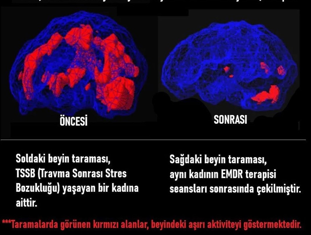 Psikolog Şirin Atçeken: İnsanoğlu bununla da baş eder - Resim: 1